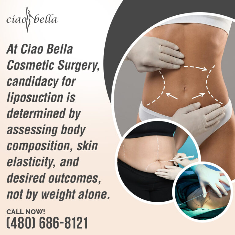 360 liposuction results